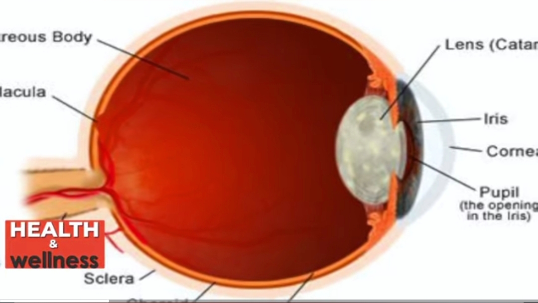 Cataracts: Diagnosis, Causes & Treatment Options